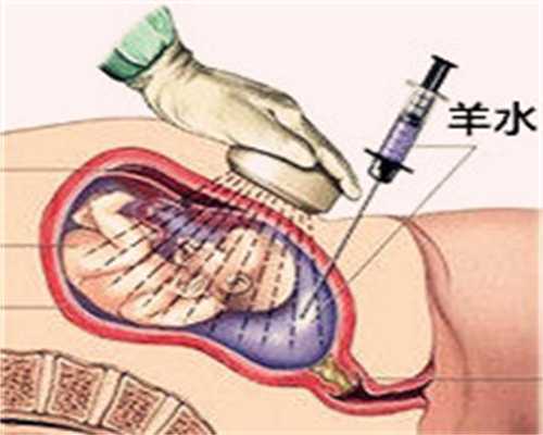 怀孕到香港验血准确吗,经阴道B超检查能看些什么？为什么一定要在月经期？