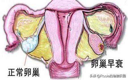 香港验血鉴别性别会不会出错,备孕期间烟酒会影响受孕吗？备孕期间抽烟喝酒