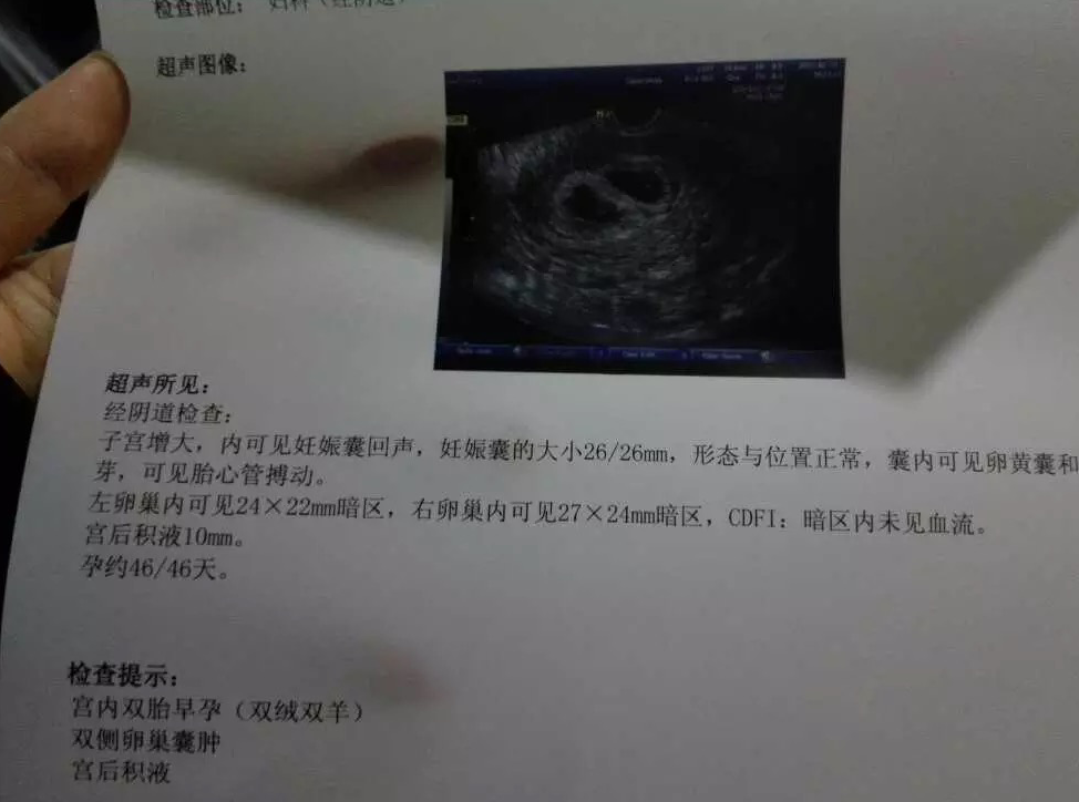 怀孕十二周可以香港验血吗,32岁妈妈试管移植诞下双胞胎，宝宝却陆续患病，希