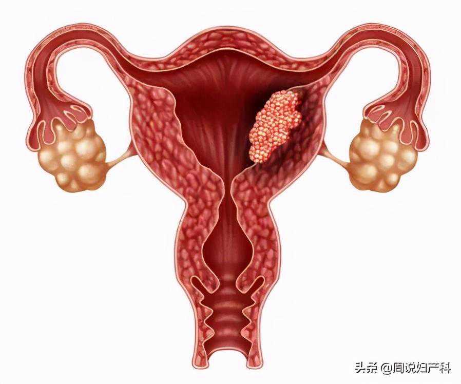 怀孕7周香港验血女儿,月经期子宫内膜脱落正常吗
