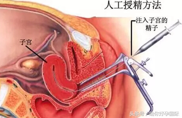 香港验血9周会有错吗,怀不上孩子究竟该人工授精还是试管婴儿？两个案例告诉
