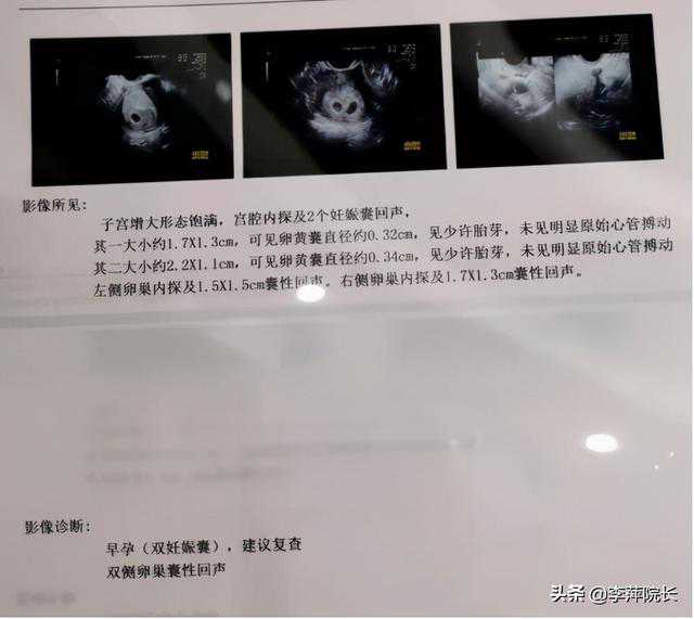 香港验血DNA检测多少钱,女子月经稀发，备孕2年要不上孩子，医院求诊：你们俩